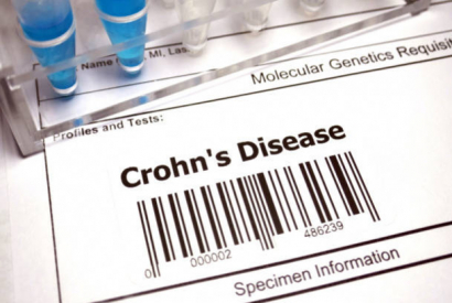 Maladie de Crohn : le CBD est-il efficace ?