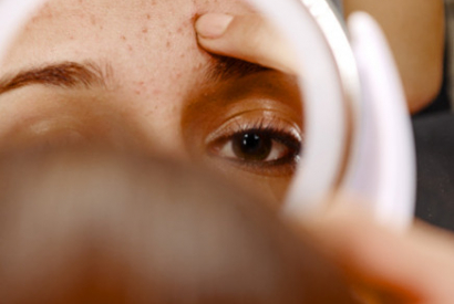 5 astuces pour lutter contre l’acné